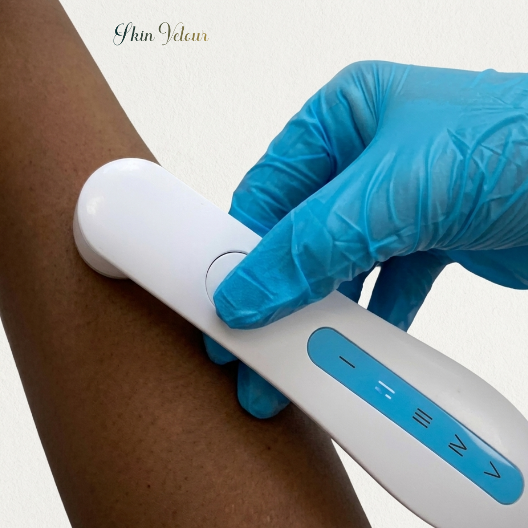 Skin Velour Portable Skin Tone Analyzer Device